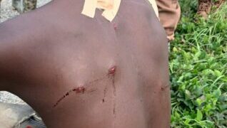 Forest Guard Shot by Suspected Illegal Loggers in Ashanti Region