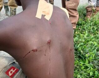 Forest Guard Shot by Suspected Illegal Loggers in Ashanti Region