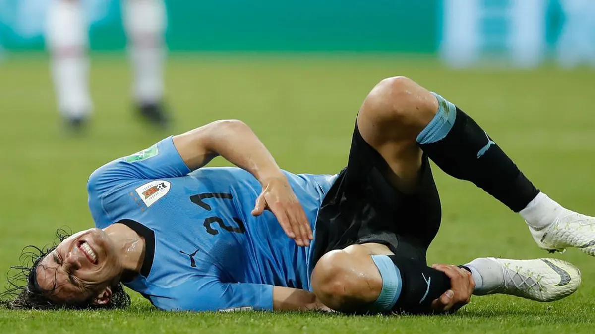 Uruguay's Cavani injured ahead of World Cup