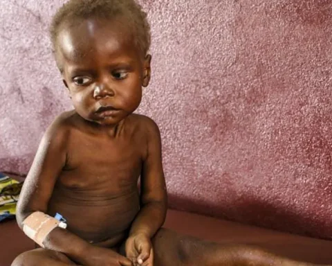 Malnutrition, anemia remain concern to UNICEF 