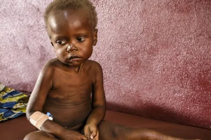 Malnutrition, anemia remain concern to UNICEF 