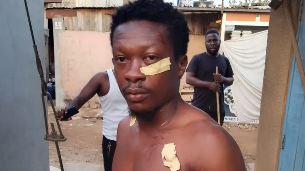 Man narrowly escapes death after multiple stabs during robbery attempt