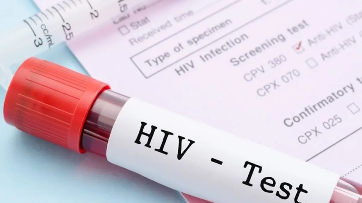 Tema Metro recorded 783 new HIV infections in 2023