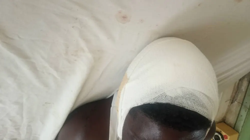 Alleged penis disappearance leads to man's assault in Senya Bereku