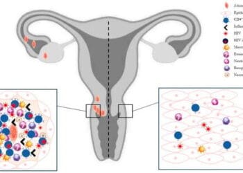 Researchers Push for Full Integration of Female Genital Schistosomiasis Into Reproductive Health Systems