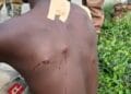 Forest Guard Shot by Suspected Illegal Loggers in Ashanti Region